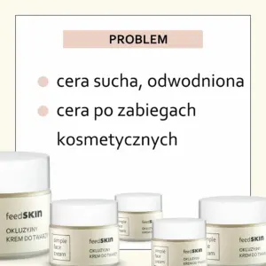 ca4d170791ca574da87bf1c159a28aa2